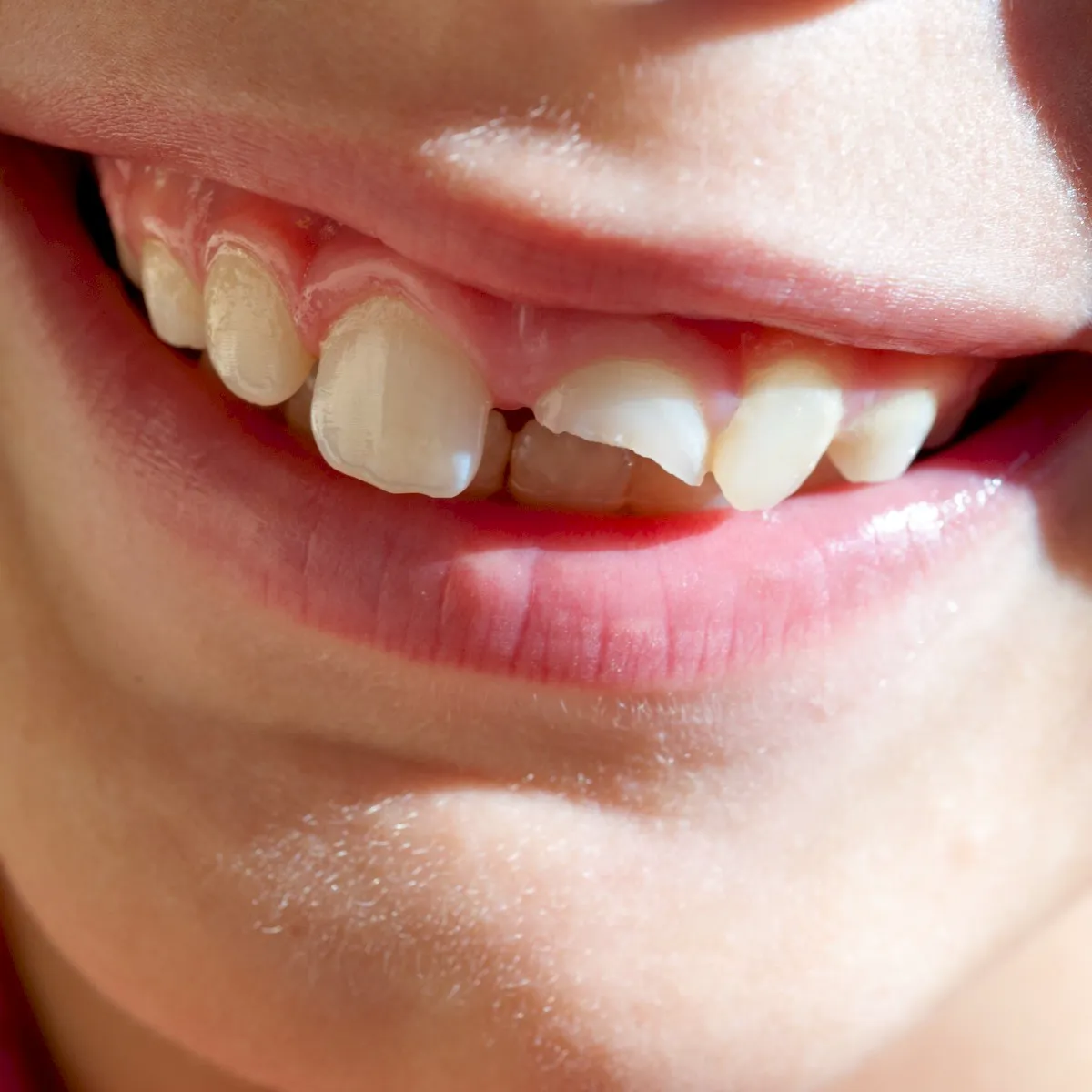 Cover of Smiling Through the Pain 2
