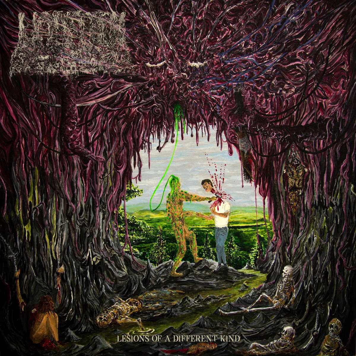 Cover of Undeath – Lesions of a Different Kind