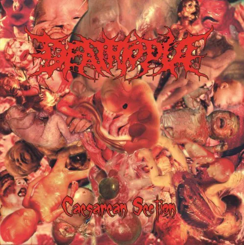 Cover of Deathtopia – Caesarean Section